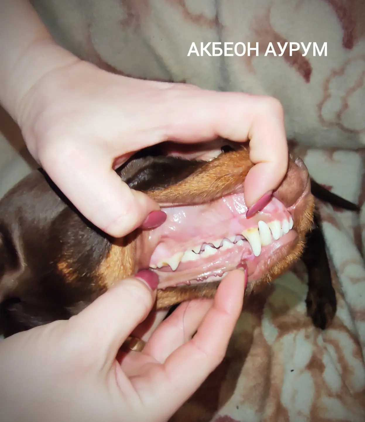 Полная зубная формула, правильное расположение зубов в челюсти