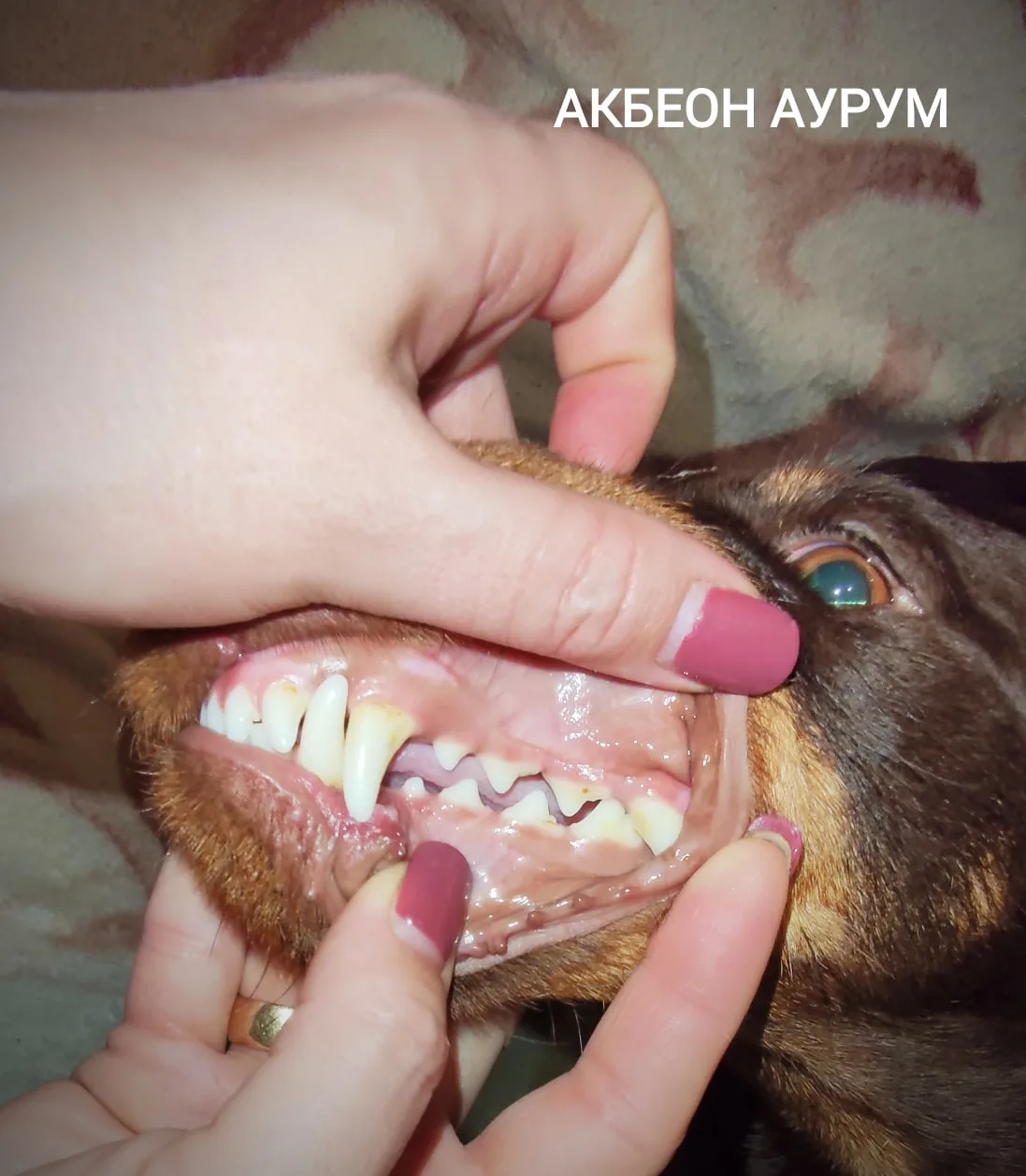 Полная зубная формула, правильное расположение зубов в челюсти